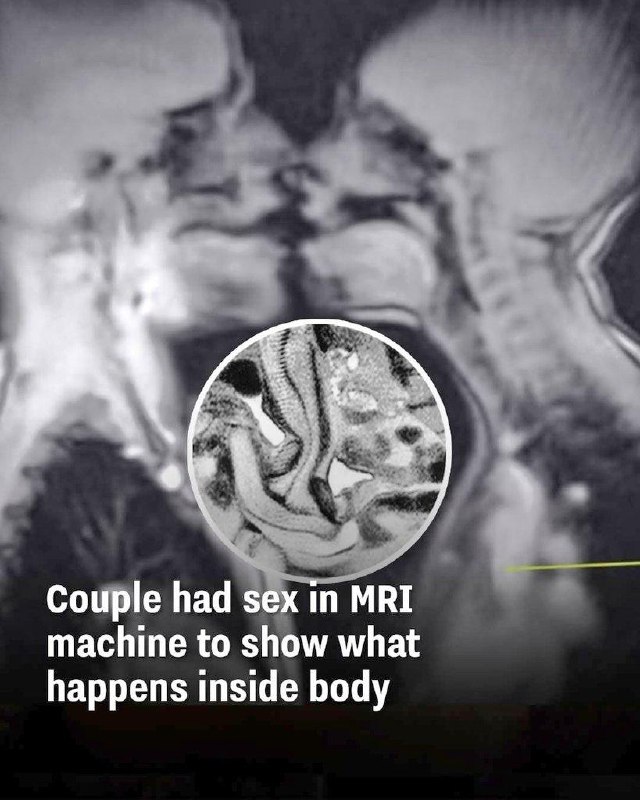 在核磁共振成像仪里做爱
