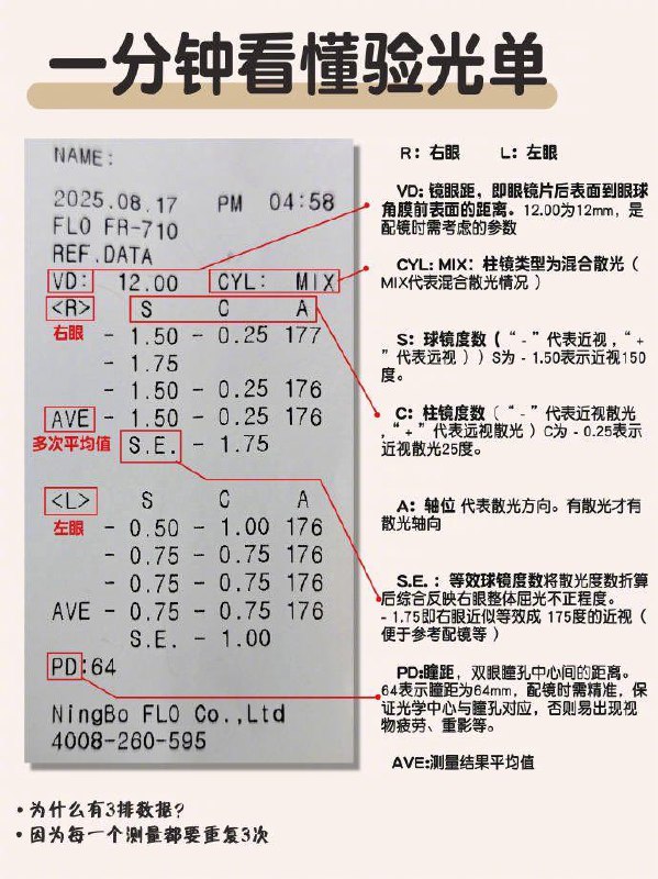 看懂验光单👀
