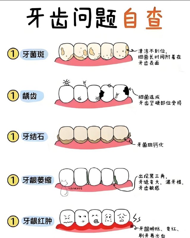 牙齿问题自查🦷🦷🦷