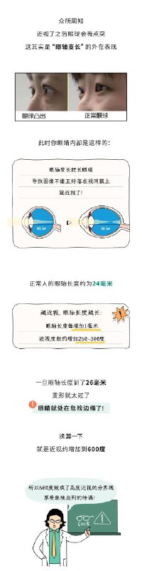 「医学科普：为什么说近视600度是一个特别重要的分界线？」通常来说50度~300度是轻度近视,300度~600度是中度近视,600度以上为高度近视