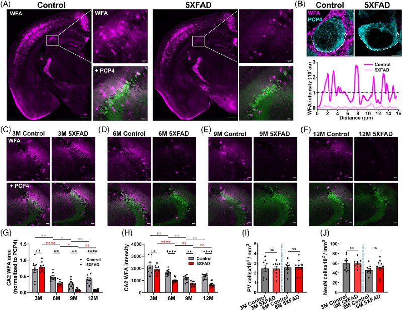 为何阿尔茨海默患者会最先遗忘亲人？对于阿尔茨海默病（AD）患者及其家庭而言，最令人心碎的症状往往不是计算能力的下降，而是逐渐无法认出至亲好友从而产生严重的社交隔阂 