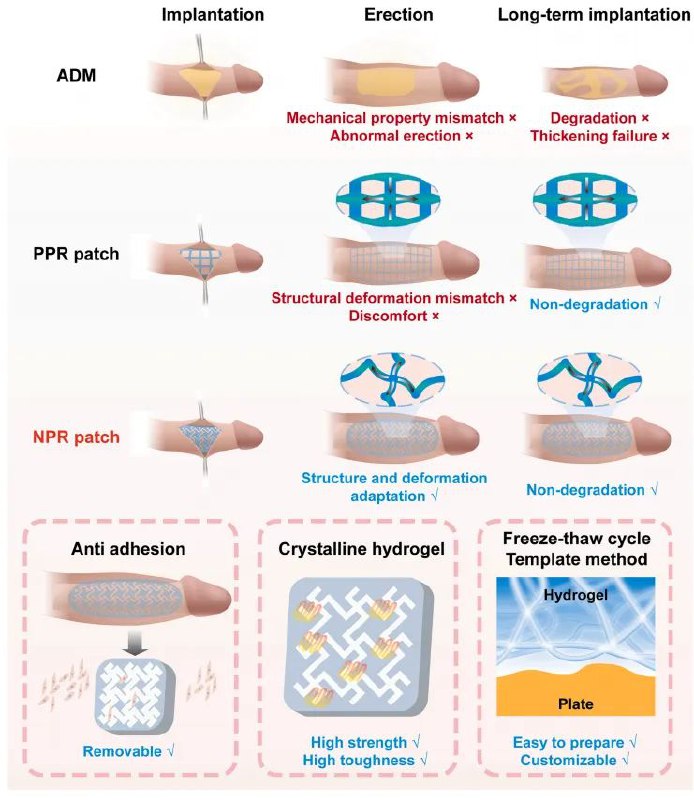 华南理工大学施雪涛开发出阴茎增粗贴片，可实现有效增粗，不易降解、长期稳定男性对阴茎的大小特别敏感，尤其是那些阴茎变形或受伤的男性