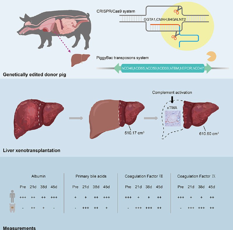 异种移植里程碑：10基因编辑猪肝“上岗”38天，助活体患者存续171天安徽医科大学第一附属医院孙倍成教授团队完成了世界首例基因编辑猪肝到活体人体的辅助移植，并于近日将成果发表于《肝脏病学杂志》 
