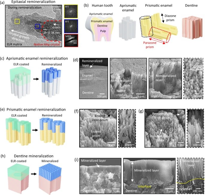 科学家研发“蛋白基质”拯救蛀牙！牙釉质（珐琅质）是人体最坚硬的组织，但一旦受损（如被酸腐蚀或磨损）便无法自我再生 