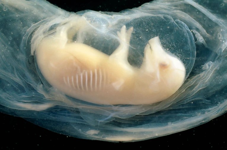 跳动的人-猪嵌合心脏，器官移植迎来新希望！据Nature News报道，在香港国际干细胞研究学会年会上展示了一项开创新的研究：科学家们首次成功在猪胚胎中培育出含有大量人类细胞并能自主跳动的心脏！这些“混血”胚胎存活了21天，为解决全球器官移植的巨大缺口带来了革命性的希望