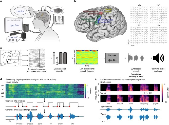 脑机接口让失语者重获“声”机《自然》杂志最新刊登的一项突破性研究中，科学家们成功开发出一种脑机接口，能够将大脑活动实时转化为语音，帮助因神经系统疾病或损伤而失去语言能力的人重获沟通的可能
