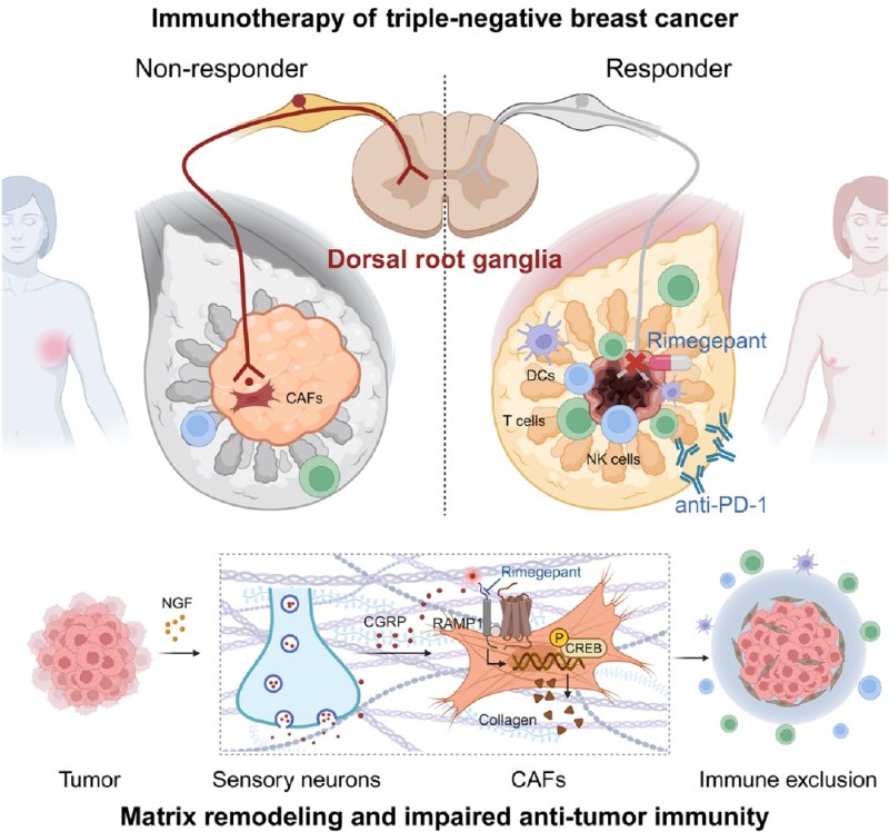 复旦团队揭示感觉神经介导免疫耐药机制，偏头痛药物或可增敏抗癌治疗复旦大学附属肿瘤医院联合多学科团队在 Cell 发表研究，首次从癌症神经科学视角揭示三阴性乳腺癌免疫治疗耐药的新机制