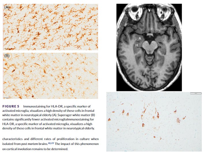 揭秘“超级大脑”：为何有人的记忆力能抵抗岁月侵蚀？面对衰老，为何有少数“超级老人”能保持着与年轻人相当的非凡记忆力？美国西北大学一项长达25年的研究，深入探究了这一现象背后的生物学秘密 