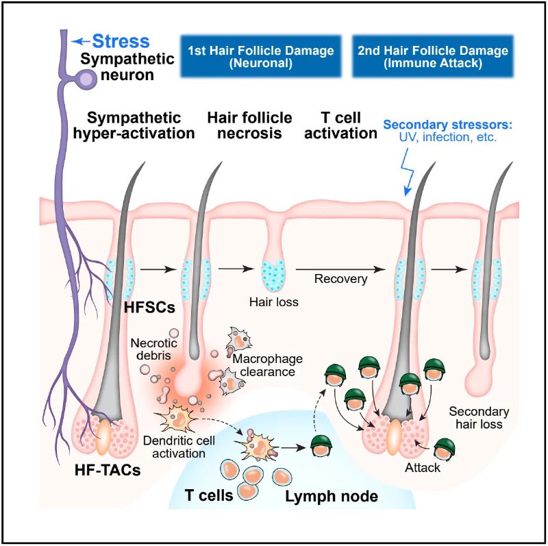 压力如何导致脱发？最新研究揭示交感神经引发毛囊坏死与自身免疫你有没有过这样的经历：工作压力大或连续熬夜后，发现头发掉得比平时多？这不是错觉，最新研究揭示了压力与脱发之间的深层机制