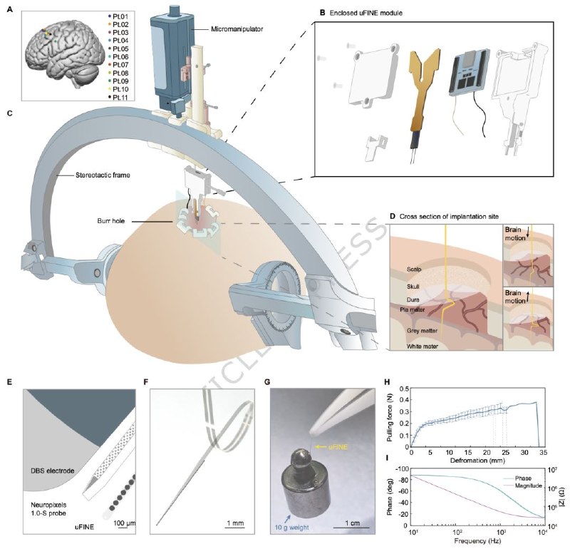 柔性电极让人类大脑“说话”更清晰：科学家首次大规模记录单神经元活动我们的大脑是地球上最复杂的器官，由数十亿个神经元通过电信号进行交流