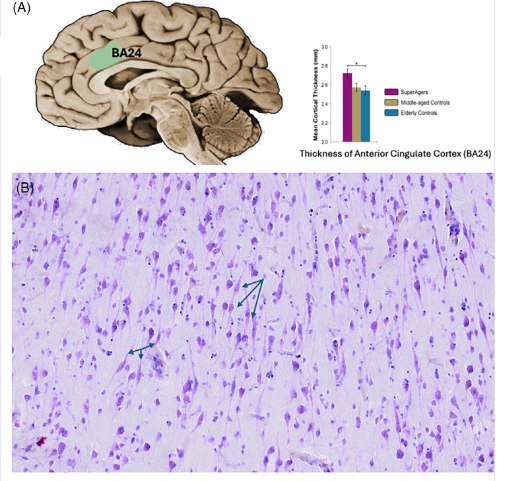 揭秘“超级大脑”：为何有人的记忆力能抵抗岁月侵蚀？面对衰老，为何有少数“超级老人”能保持着与年轻人相当的非凡记忆力？美国西北大学一项长达25年的研究，深入探究了这一现象背后的生物学秘密 