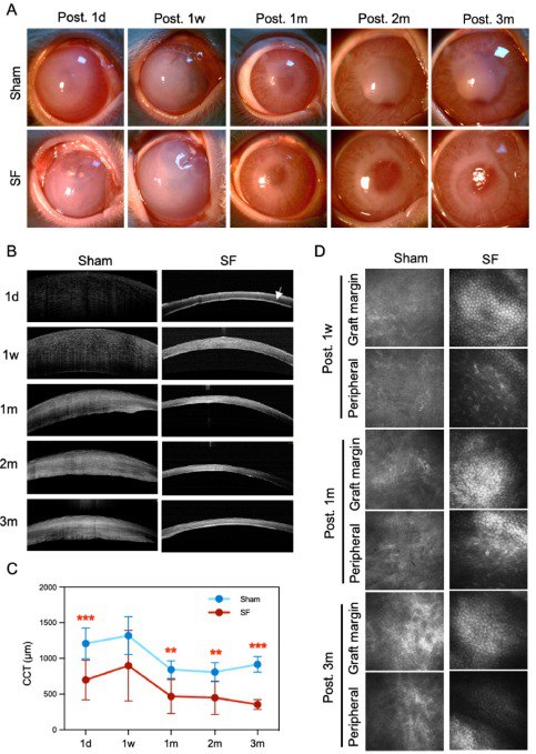 中国科学家用蚕丝开发出可降解人工角膜内皮！角膜内皮功能障碍是导致角膜盲的主要原因之一
