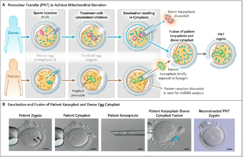“三亲婴儿”里程碑：8名英国宝宝健康诞生，改写线粒体遗传宿命英国纽卡斯尔生育中心近期在《新英格兰医学杂志》上发布了两篇里程碑式论文，详细披露了全球首批通过线粒体捐赠技术诞生的“三亲婴儿”的健康状况
