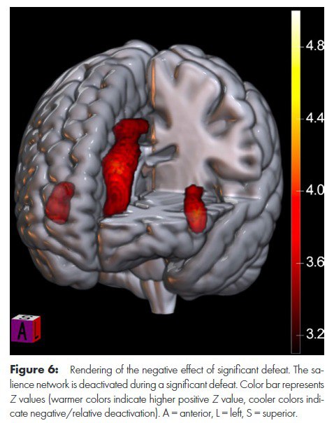 赢球“上瘾”，输球“失控”？fMRI揭示极端狂热大脑的神经根源为什么一场球赛能让人欣喜若狂或悲痛欲绝？对于铁杆球迷来说，这关乎身份认同