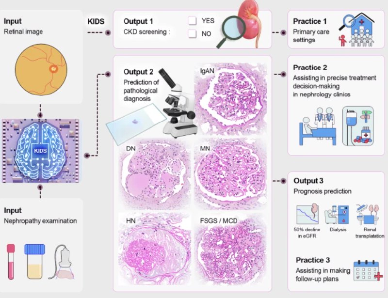 新 AI 模型“看眼底”就能诊断肾病？慢性肾病（CKD）的精准诊断长期依赖于肾脏穿刺活检 —— 一种有创、昂贵且存在风险的检查