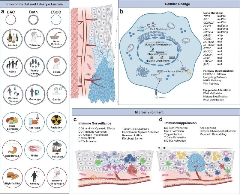 食管癌的分子机制与精准治疗新突破：从发病到治愈的路径探索食管癌是全球常见的恶性肿瘤，尤其在中国，其发病率和死亡率居高不下