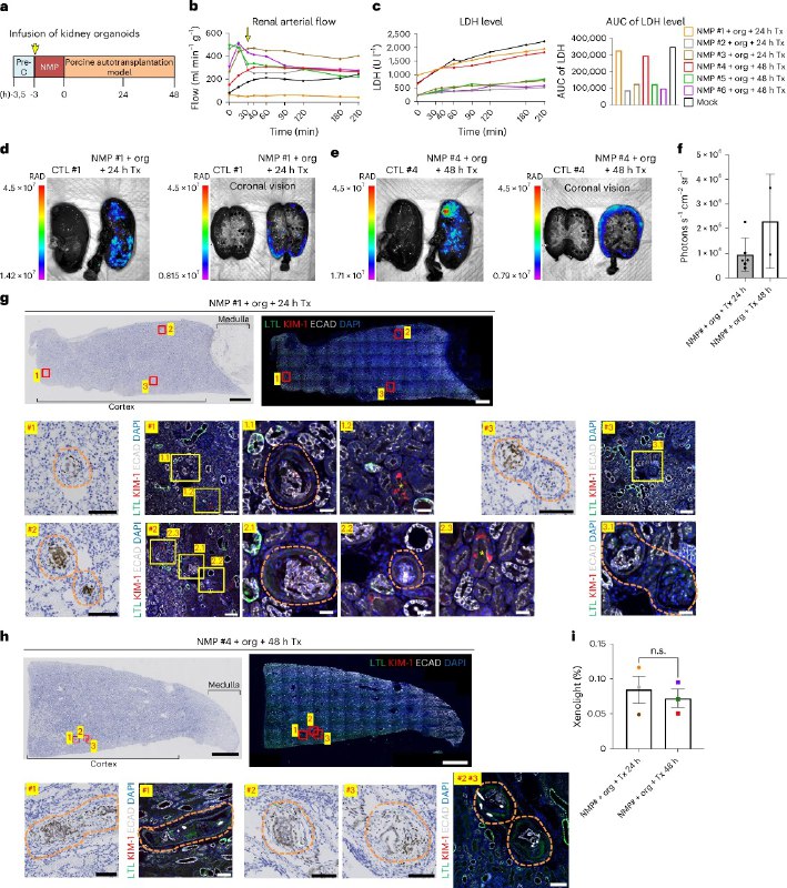 人类“迷你肾脏”植入猪肾！新研究展示“器官修复”潜力面对全球性的器官短缺，科学家一直在尝试再生和修复器官