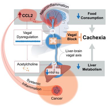 癌症恶病质的“神经开关”被找到：《细胞》揭示阻断脑 - 肝迷走神经可逆转致命消耗癌症相关的恶病质是一种致命的全身性代谢紊乱，导致患者严重消瘦，目前尚无有效疗法