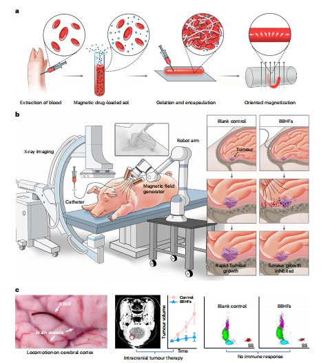 “血液特工”诞生：科学家用自体血造出抗癌微型机器人近日，《自然·生物医学工程》上的一项研究展示了一种极具前景的脑肿瘤个性化治疗新策略