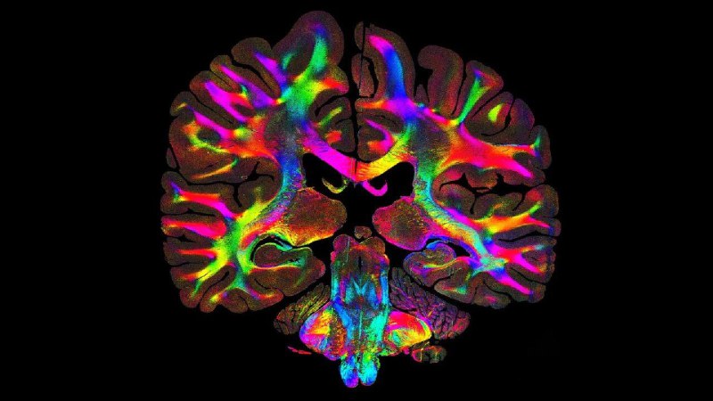 用光看透百年旧片：一种新方法让组织纤维结构清晰可见人体内的每一块组织都含有极其微小的纤维，它们协调着器官的运动、功能和通讯