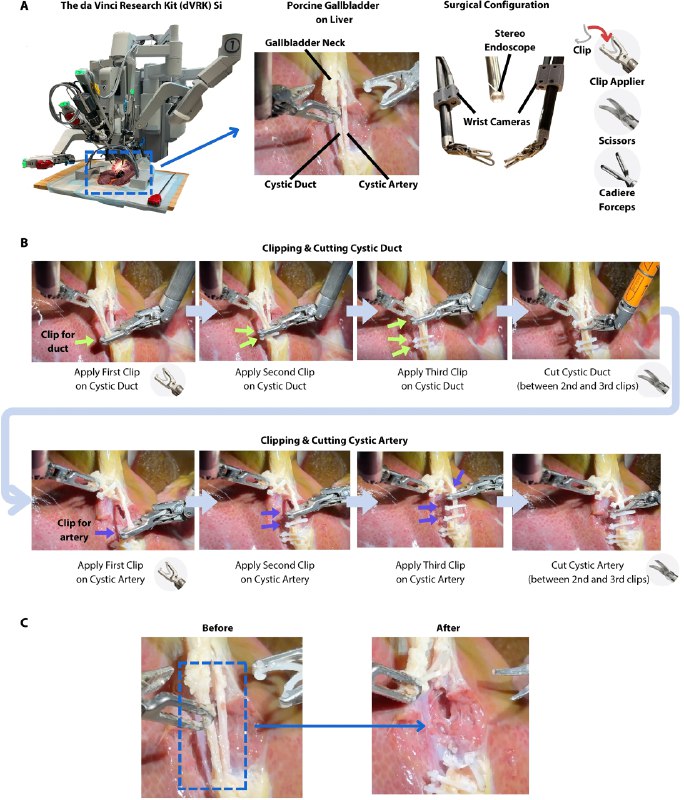 AI外科医生秀绝活：自主完成高难度手术