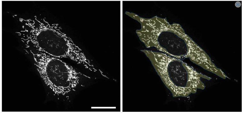 精准“点火”线粒体，逆转阿尔兹海默症小鼠记忆缺陷众多脑部疾病与细胞“能量工厂”线粒体的功能障碍相关，但其间的因果关系长期以来尚不明确 